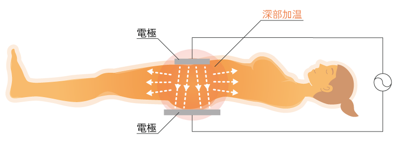 インディバ施術による効果のイラスト